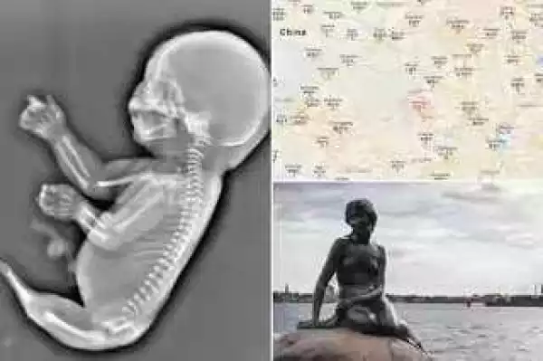 OMG!!! Mom Terminates 6 Months Pregnancy After Doctors Told Her She Would Give Birth To A Mermaid